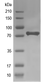 Western blot of AKAP8 recombinant protein