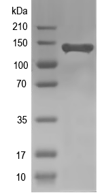 Western blot of ALA7 recombinant protein