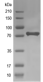 Western blot of ALKBH8 recombinant protein