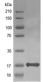 Western blot of ALMT11 recombinant protein