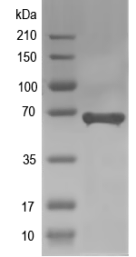 Western blot of APRR5 recombinant protein