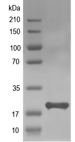 Western blot of ARF1 recombinant protein