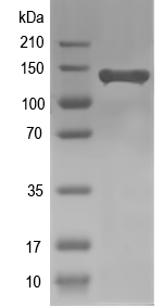 Western blot of Abcb4 recombinant protein