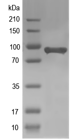 Western blot of At1g61370 recombinant protein