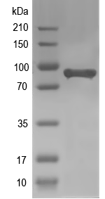 Western blot of At1g62320 recombinant protein