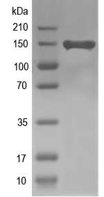 Western blot of At1g63210 recombinant protein