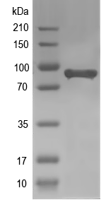 Western blot of CDHR5 recombinant protein