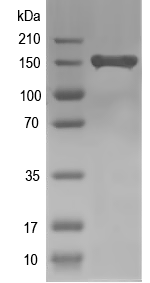 Western blot of CG7457 recombinant protein