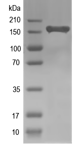 Western blot of CHD1 recombinant protein