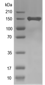 Western blot of CHD1 recombinant protein