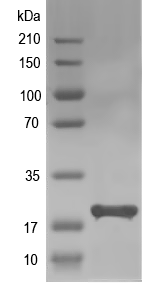 Western blot of CNA04680 recombinant protein