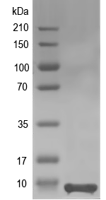 Western blot of DDB_G0267930 recombinant protein