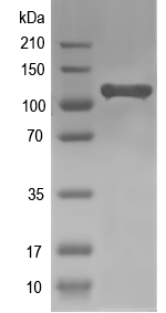 Western blot of DDB_G0268642 recombinant protein