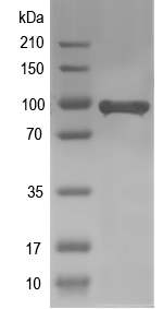 Western blot of FCHO1 recombinant protein