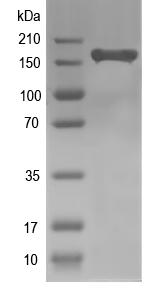 Western blot of KDM5B recombinant protein