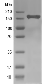 Western blot of KDM5C recombinant protein