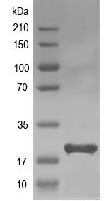 Western blot of MA_3117 recombinant protein