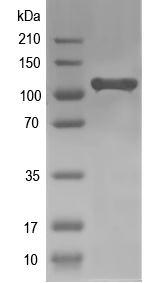 Western blot of NAT10 recombinant protein