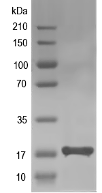 Western blot of NRAC recombinant protein