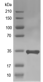 Western blot of NUDT7 recombinant protein