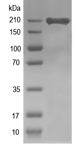 Western blot of NYNRIN recombinant protein