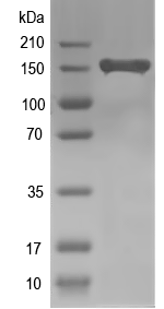 Western blot of ORF1 recombinant protein