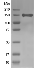Western blot of PLEKHG1 recombinant protein