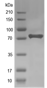 Western blot of Rasgrp4 recombinant protein