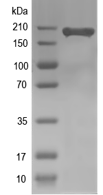 Western blot of SNF2 recombinant protein