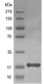 Western blot of Tmem91 recombinant protein