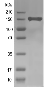 Western blot of abcC3 recombinant protein