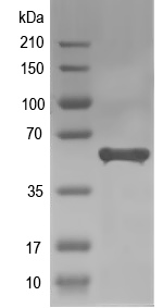 Western blot of cobQ recombinant protein