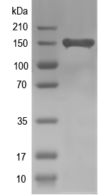 Western blot of dcl2 recombinant protein