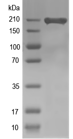 Western blot of fasA recombinant protein