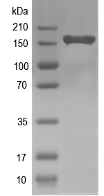 Western blot of ph-p recombinant protein