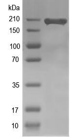 Western blot of prtP recombinant protein