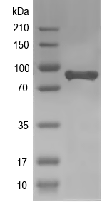 Western blot of rskn-1 recombinant protein