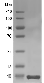Western blot of yjhX recombinant protein