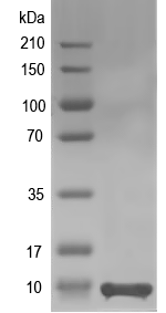 Western blot of yjhX recombinant protein